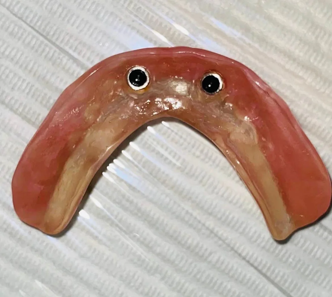 Parte interna da overdenture com encaixes